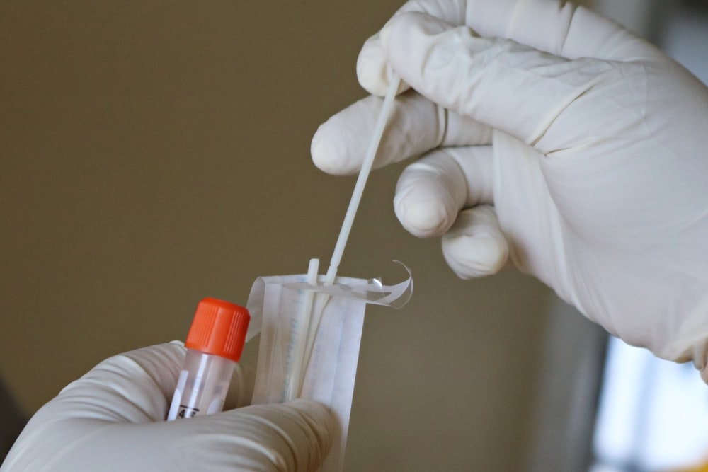A swab test kit